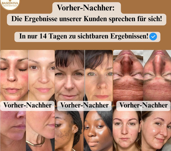 Natürliches Tallow Balsam mit Honig